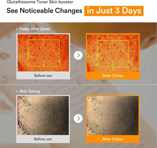 Abib Glutathiosome Dark Spot Toner - Skin Brightening Booster | 6.76 Fl Oz