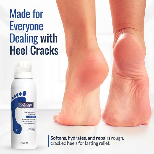 Footlogix Cracked Heel Formula - Repair Dry, Cracked Skin | 4.23 Ounce White Cream