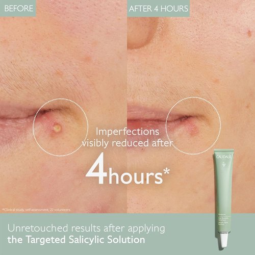 Caudalie Vinopure Color Correcting Spot Solution - Salicylic Acid Treatment, 15 mL