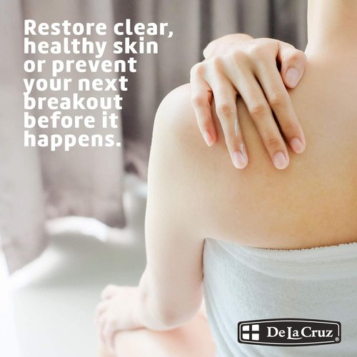 De La Cruz Sulfur Ointment - Effective Cystic Acne Treatment for Face & Body - 2.6 OZ Tube, 2-Pack