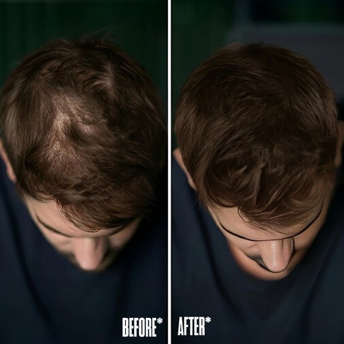 Hairline Powder, Root Touch Up Dark Brown, Instant Hair Loss Concealer for Thinning Hair, Windproof & Sweatproof Hair Root Cover Up Powder with Mirror and Puff