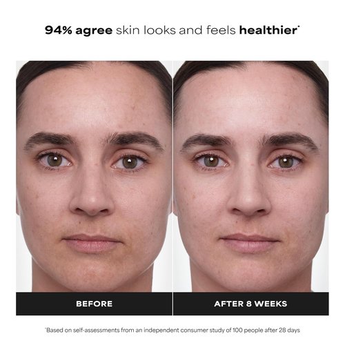 Paula's Choice Clinical 1% Retinol Face Treatment - Anti-Aging Serum with Peptides & Vitamin C | Fragrance-Free