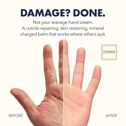 Onsen Nail & Cuticle Rescue Kit - Strengthening Conditioner Serum, Repair Oil & Balm | Hydrating Tsubaki, Shea Butter & Jojoba (15ml Serum + 10ml Oil + 32.5ml Cream)