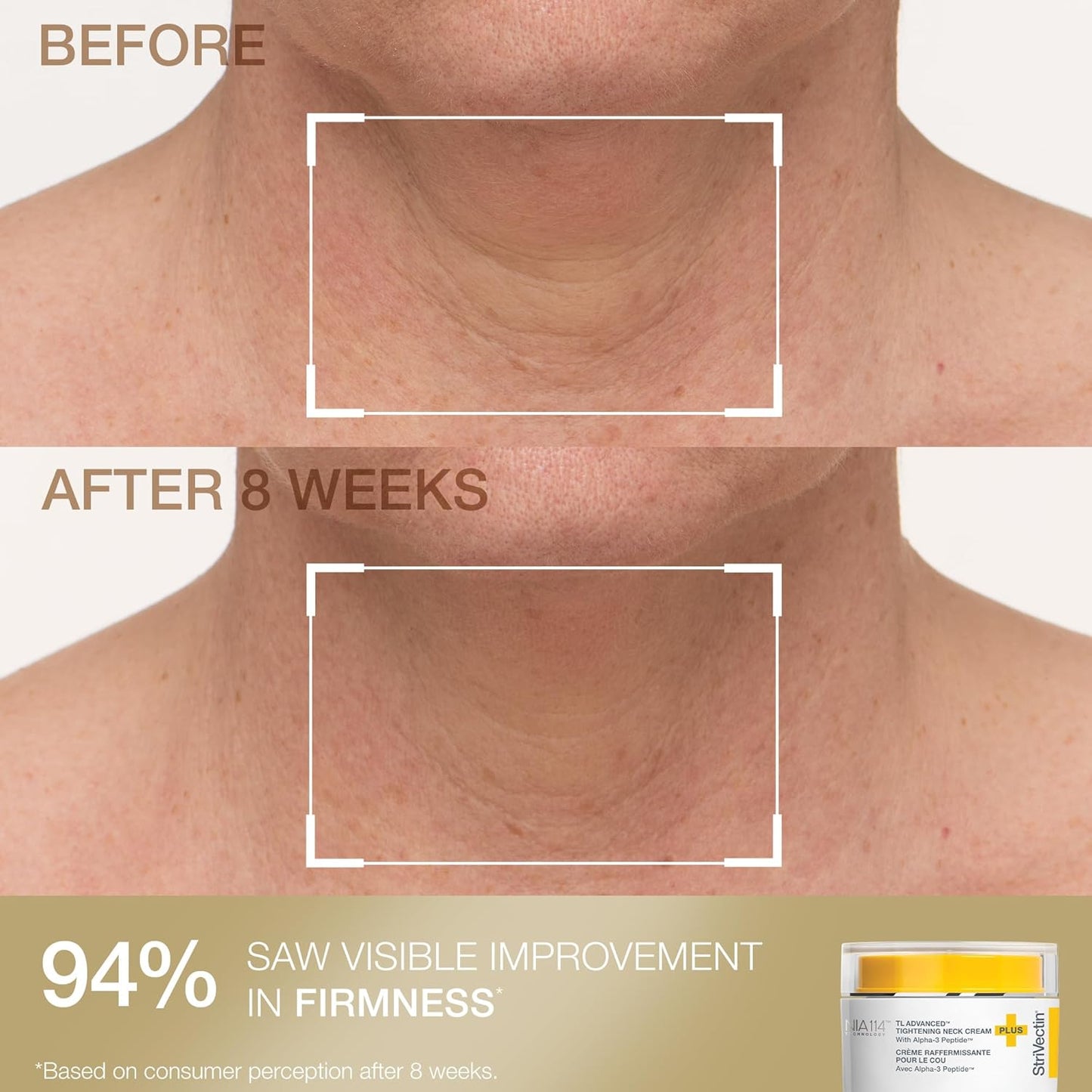 StriVectin Neck Cream & Serum Roller Set - Anti-Aging Formula for Smoother Skin & Reduced Wrinkles