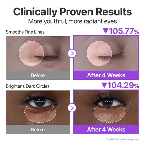 numbuzin No.9 NAD+ Retinol Eye Cream, Depuffing & Firming Eye Serum for Dark Circles, Wrinkles & Fine Lines, Peptides & Niacinamide for Glow & Undereye Radiance, Stocking Stuffers 0.33 fl oz