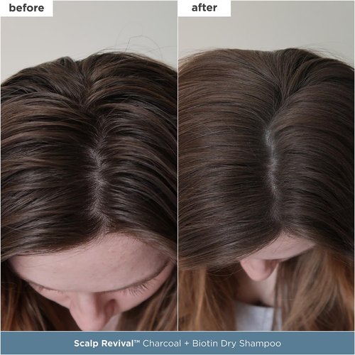 Briogeo Scalp Revival Set - Detox & Hydrate Your Scalp with Charcoal & Tea Tree | Vegan & Cruelty-Free