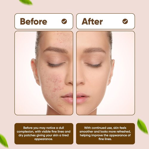 Dinur Cosmetics Bio Clean Drying Lotion - Targeted Spot Care for Oily & Blemish-Prone Skin | 0.68 fl oz