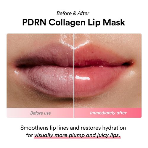 Abib PDRN Collagen Lip Mask - Hydrating Jelly Lip Butter Balm | 0.38 fl oz Overnight Treatment for Dry Lips
