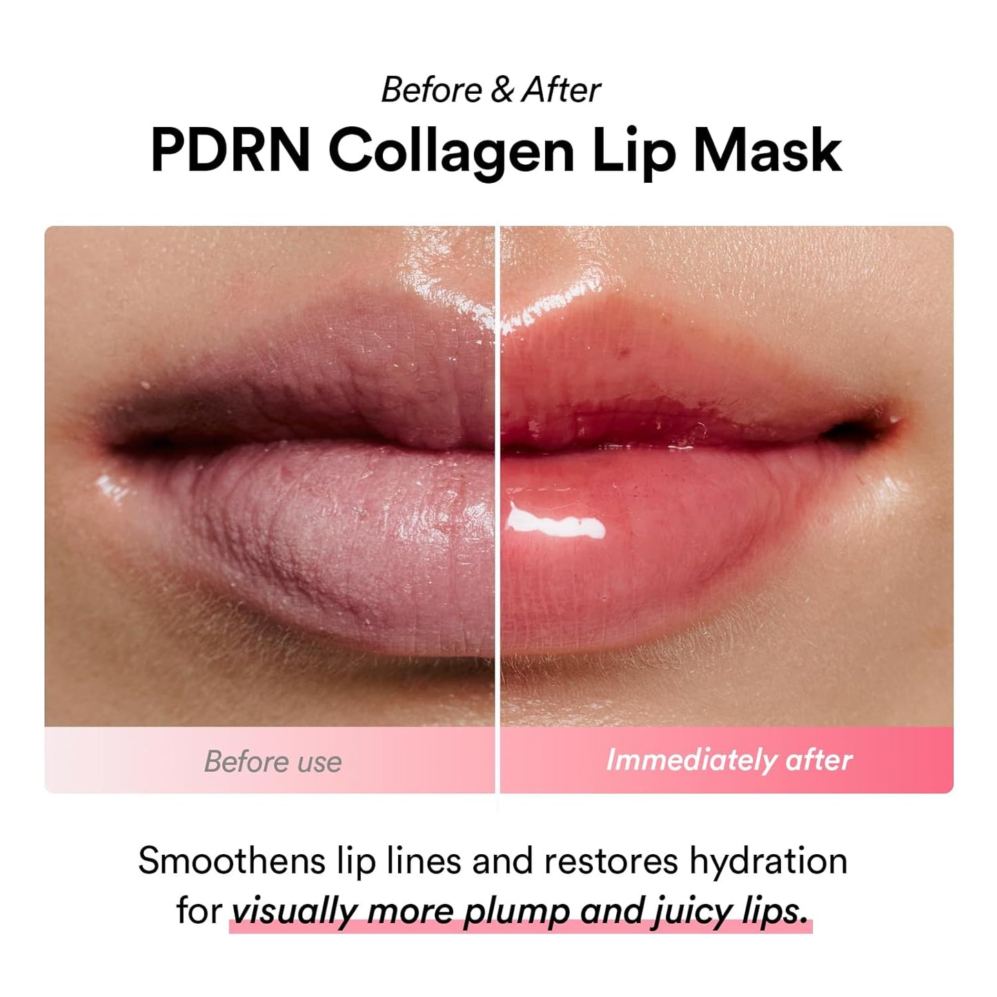 Abib PDRN Collagen Lip Mask - Hydrating Overnight Jelly Balm for Dry, Flaky Lips | 0.38 fl oz