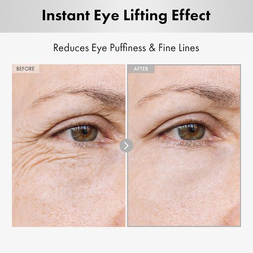 NATUREKIND Hyaluron Lifting Eye Cream - Hydrating Formula with Hyaluronic Acid & Niacinamide | 15ml