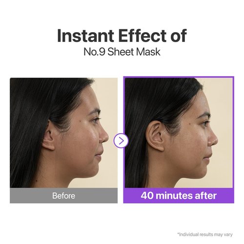 Numbuzin No.9+ NAD+ Bio Lifting Full Face Mask - Peptide & Collagen Firming Treatment, 4 Sheets + Lifting Band