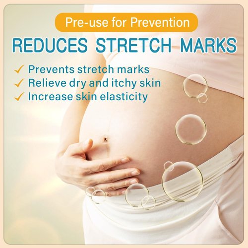PEGO Stretch Mark Butter - Maternity Cream for Reducing Scars & Moisturizing Skin | 100g/3.53oz