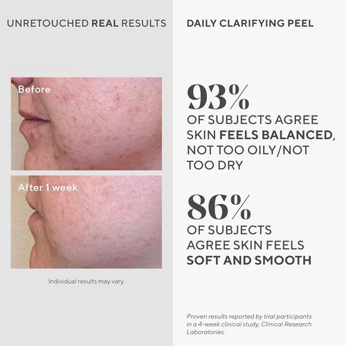 Murad Daily Clarifying Peel - AHA/BHA Exfoliating Liquid with Retinoid & Salicylic Acid - 3.2 Fl Oz