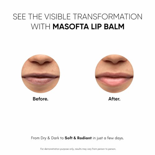 Masofta Shea Butter Lip Balm - Smooth, Crack-Free Lips with Kojic Acid & SPF 30 | 0.52 oz