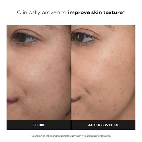 Paula’s Choice Pro Retinaldehyde Serum - High Potency Anti-Aging Treatment for Radiant Skin | Fragrance-Free