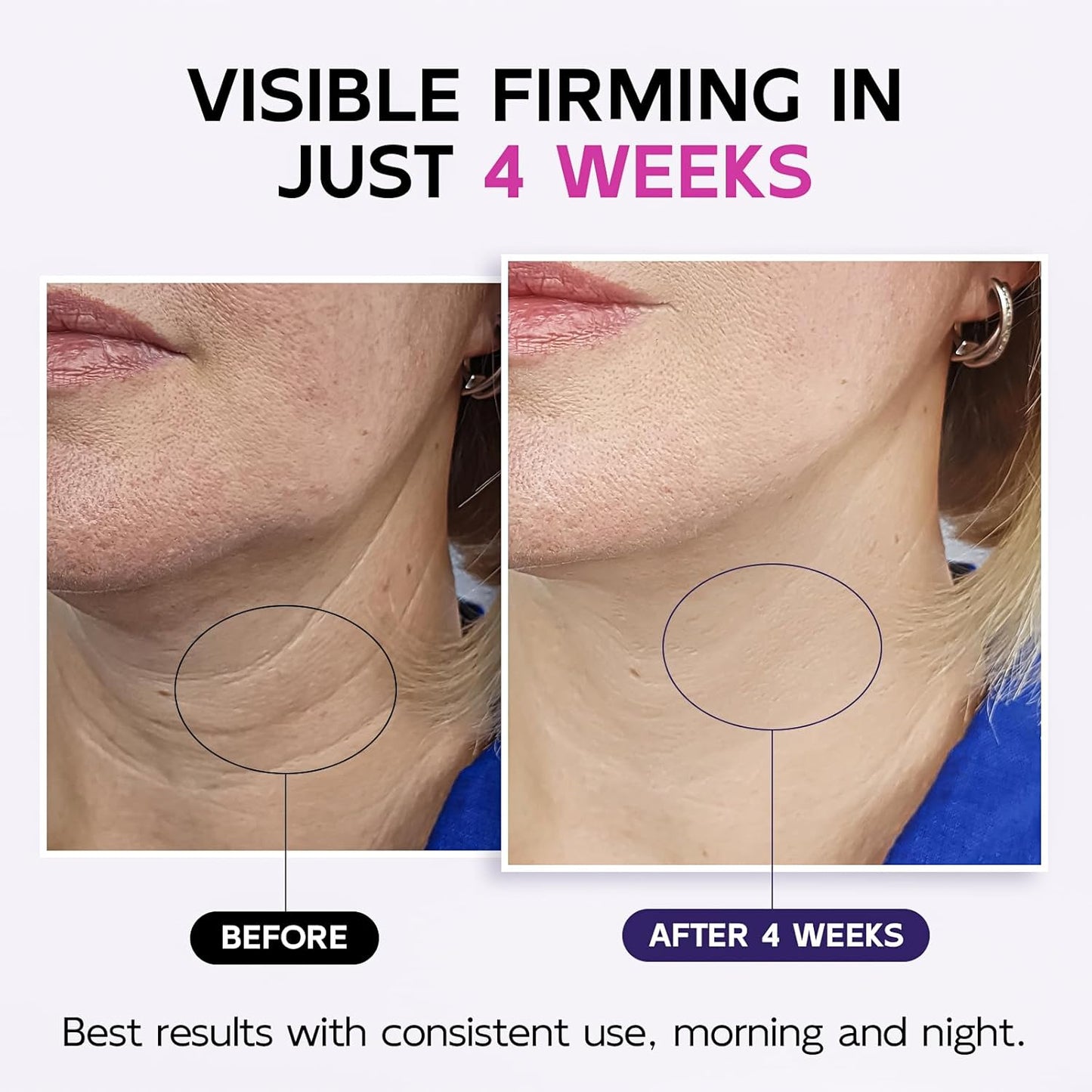 Skiennix Neck Firming Cream - Tighten & Lift with Multi-Peptide, Retinol & Collagen | 4.3 Fl Oz