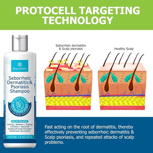 Roycederm Seborrheic Dermatitis Shampoo - Relieves Itching & Flaking for Dry, Itchy Scalp