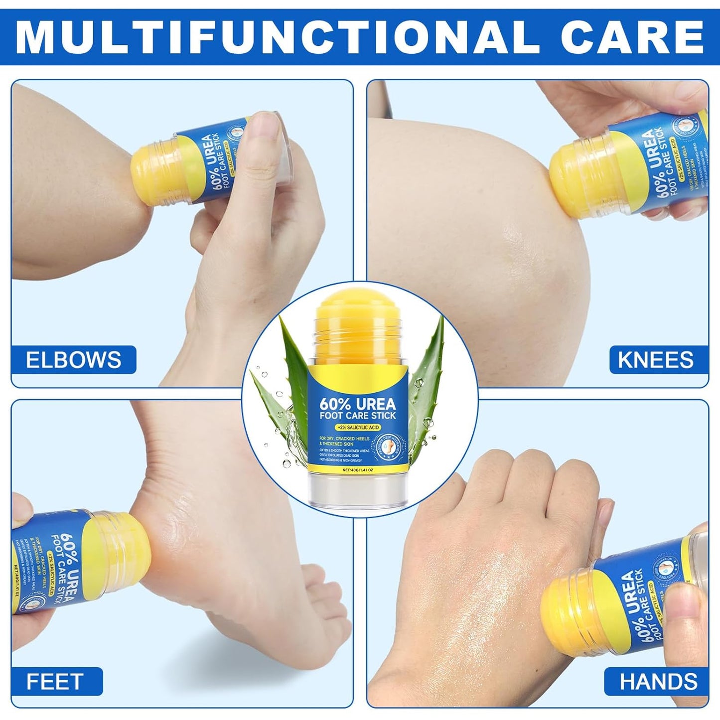 Skiennix 60% Urea Cream Stick - Maximum Strength Foot Cream with 2% Salicylic Acid | Softens Dry Cracked Heels