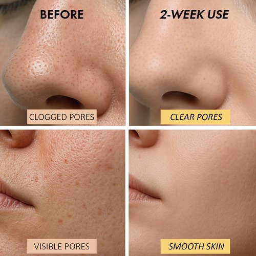 Roseblem Warming Clay Facial Mask for Deep Pore Cleansing – Self-Heating Mud Mask for Face, Purifying & Pore-Refining Treatment, Helps Remove Blackheads, Improves Skin Texture, Spa-Like Care, 4.94Oz