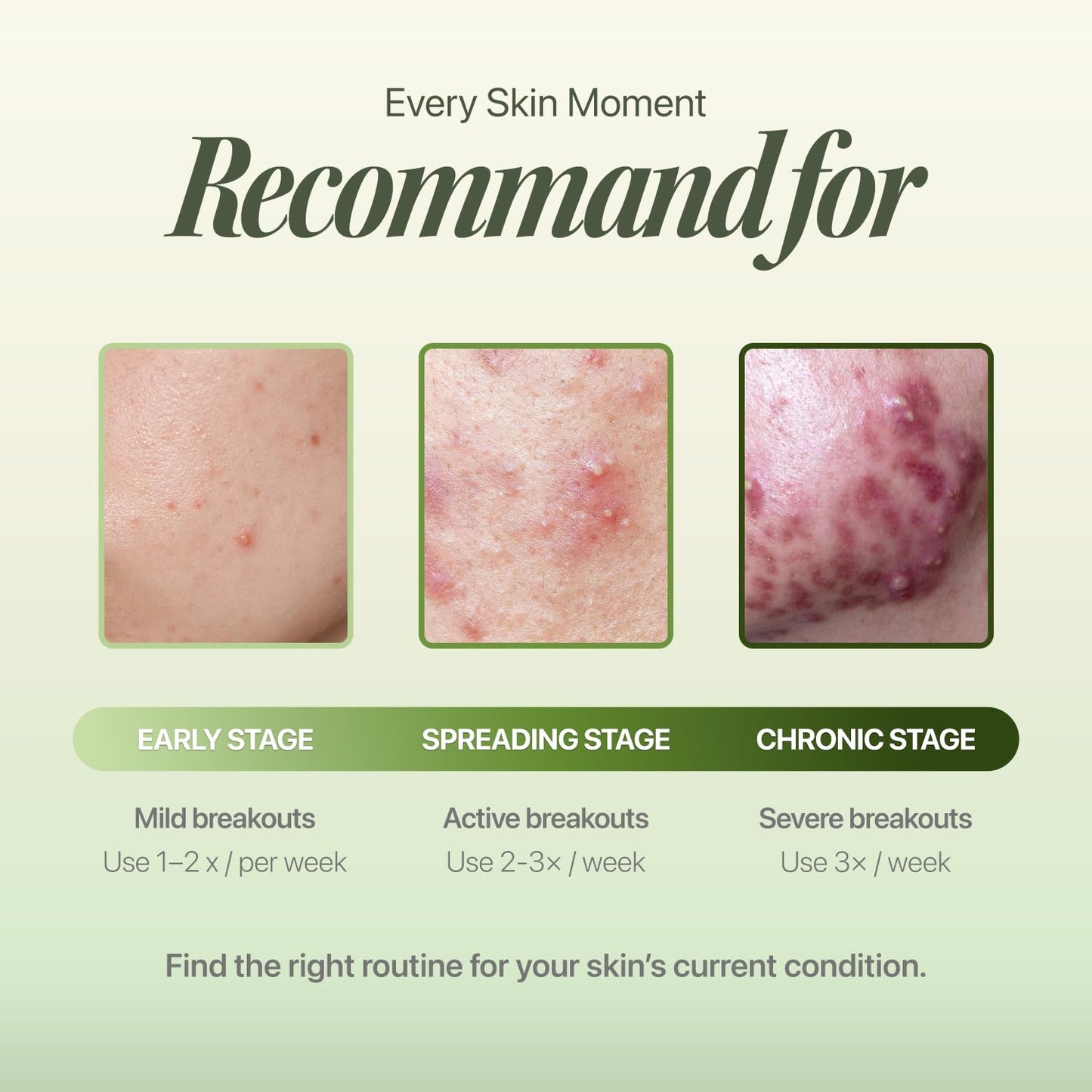 Trouble Patch Mask - Hydrocolloid Acne Face Mask for Pimple-Prone Skin | Oil Absorbing, Full Face Treatment (20ml x 4)