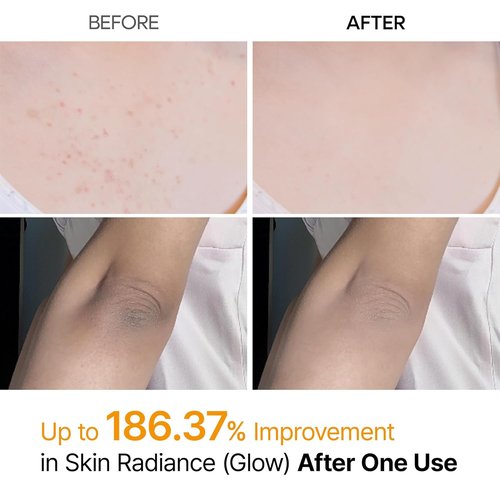 Dr. Melaxin Body Keratin Care Spray - Kojic Acid & Turmeric Exfoliating Solution | 6.76 fl. oz.