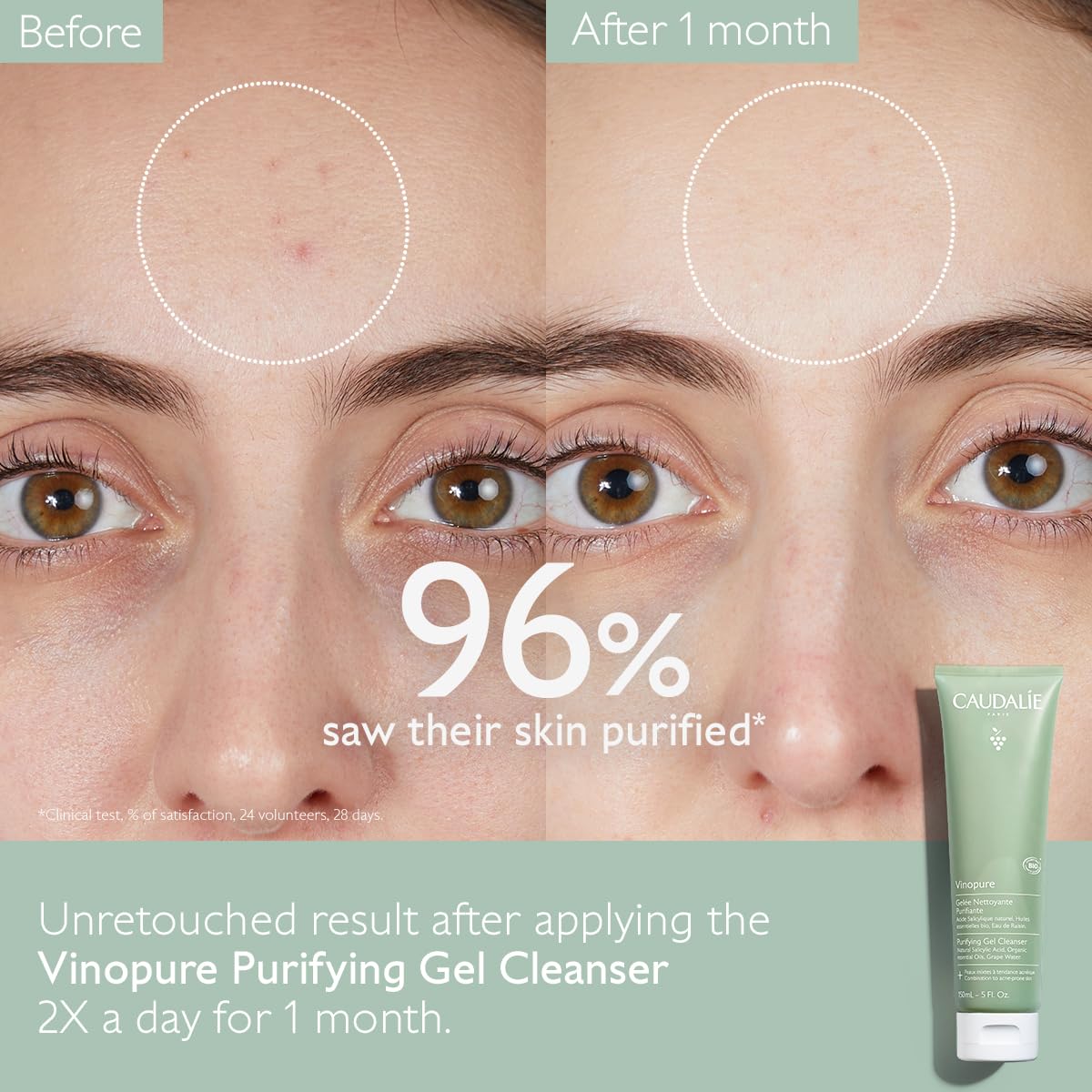 Caudalie Vinopure Salicylic Acid Cleanser - Pore Purifying Gel, 150 mL (Pack of 2)