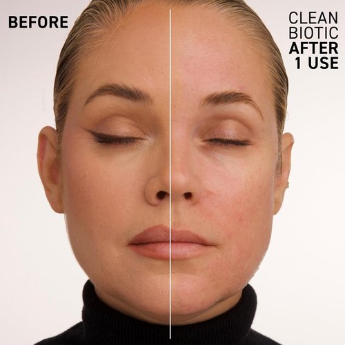 Dr. Brandt Clean Biotic - pH-Balancing Yogurt Cleanser - Removes Dirt, Makeup & Oil - 3.5 fl oz