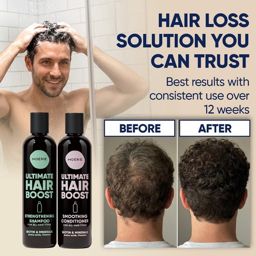 Moerie Hair Growth Shampoo & Conditioner | Biotin & Rosemary Formula for Thinning Hair – Promotes Regrowth