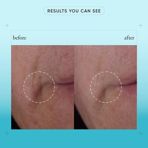Philosophy Dose Of Wisdom Bouncy Skin Reactivating Facial Serum - Hyaluronic Acid & Vitamin C for Radiant Skin