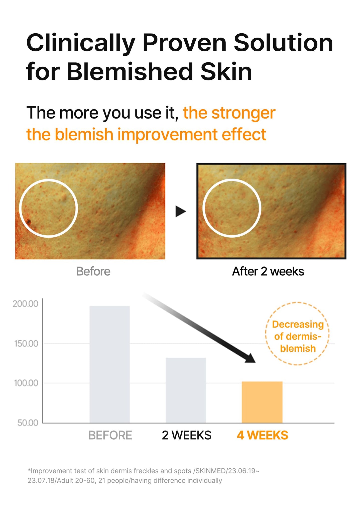 celimax Pore+Dark Spot Brightening Serum 30ml | Gel-like Serum for Enlarged Pores with Niacinamide, Tranexamic Acid, Pore Minimizer, Non-Irritating, Hydrating, For Sensitive Skin