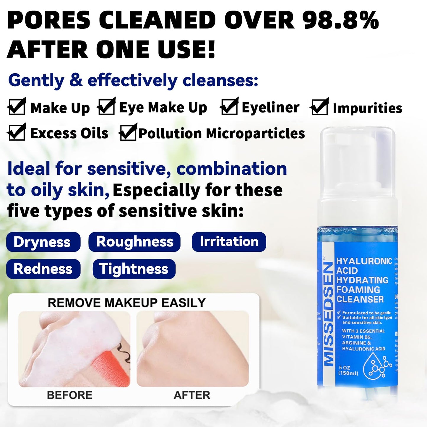 Skiennix Face Wash - Oil Control Foaming Cleanser for Acne & Oily Skin | Fragrance-Free, 5 oz