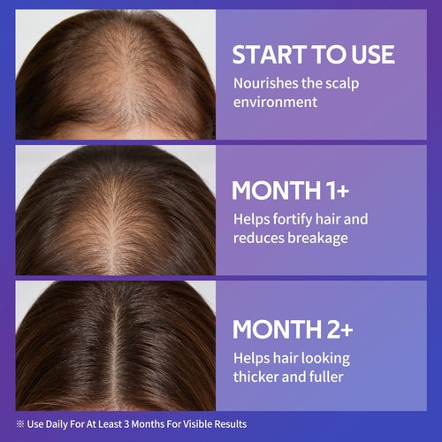Hair Growth Serum Spray with Rosemary Oil, Biotin & Caffeine, Fast Absorbing Non-Greasy Scalp Serum for Fuller-Looking Hair, Alcohol-Free Nourishing Scalp Spray for Women & Men, 60ml