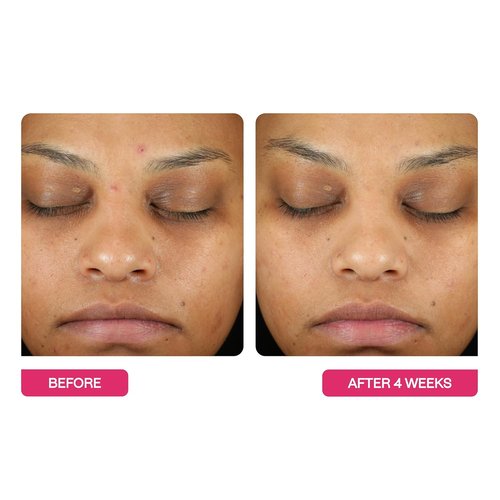 BeautyStat Triple Action Daily Exfoliating Peel Pad - Gentle AHA/BHA Formula for Uneven Tone & Fine Lines - Made in the USA