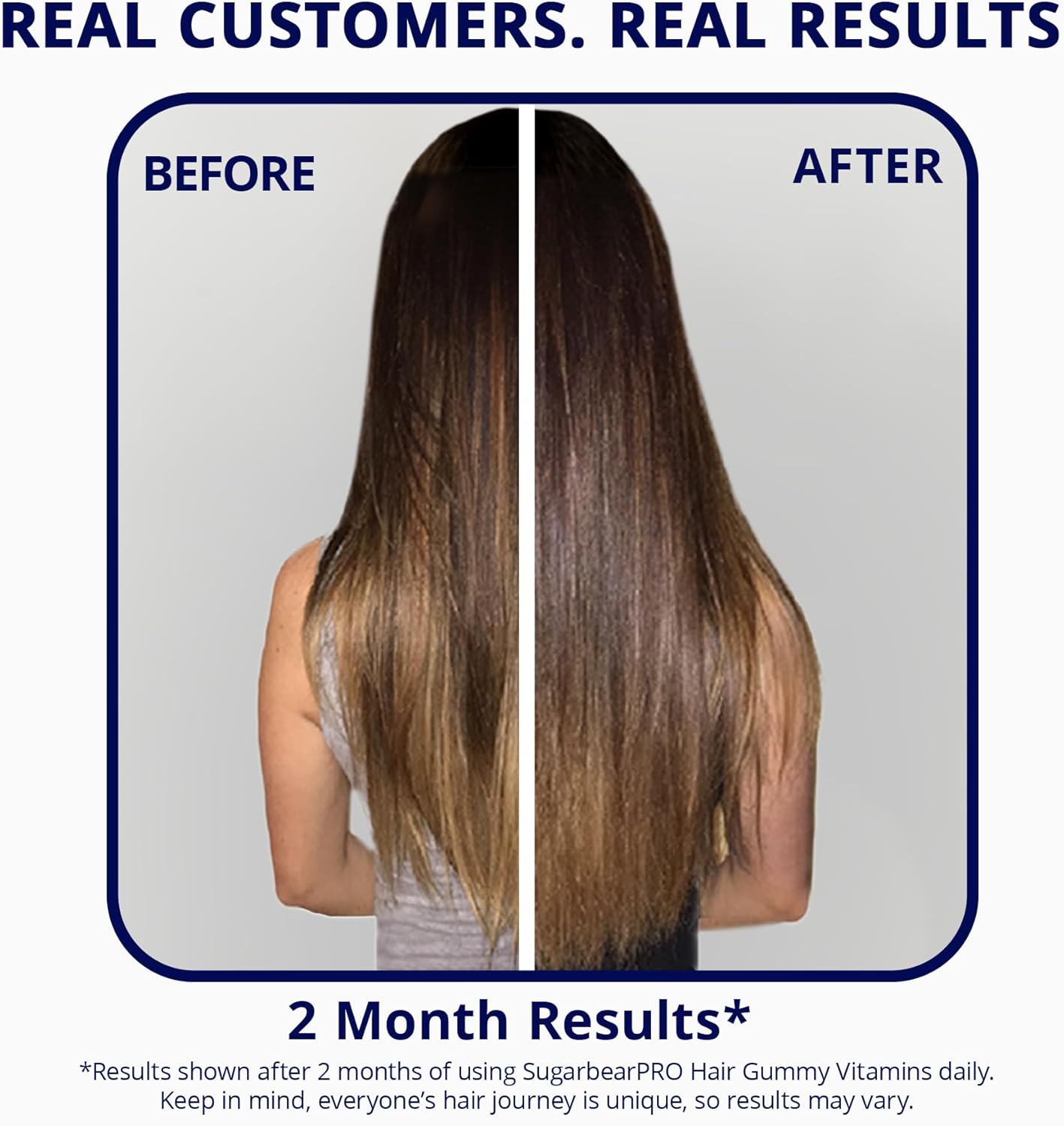 SugarBearPro Hair Vitamins - Extra Strength Biotin Gummies for Hair Growth | 1 Month Supply, Vegan & Kosher