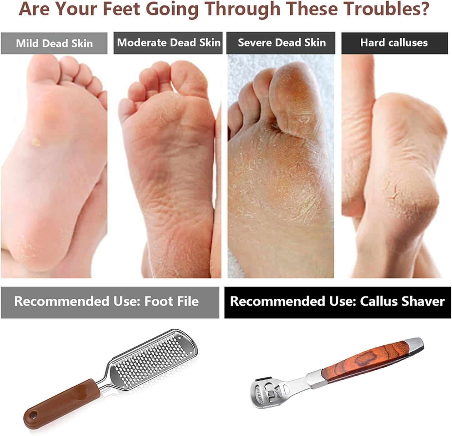 Skiennix Colossal Foot Rasp & Callus Shaver Kit - 10 Replacement Heads & Wood Handle for Smooth Feet