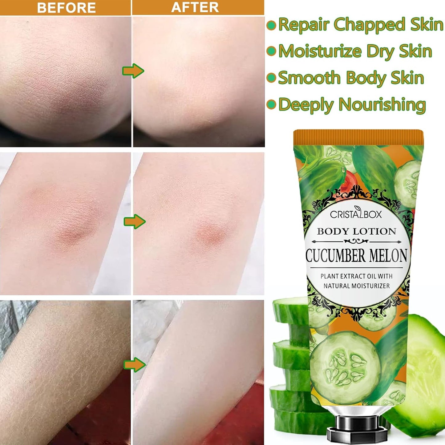 Skiennix 36-Pack Body Lotion for Dry Skin - Natural Shea Butter Moisturizer | Perfect Gift Set