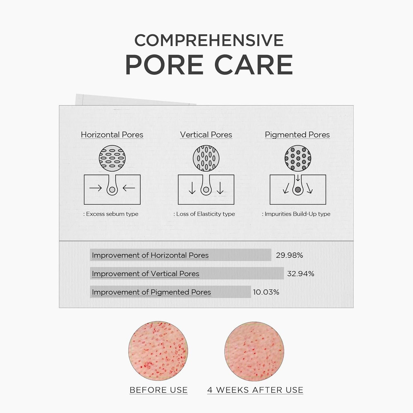 SKIN1004 Niacinamide 10% Boosting Shot Ampoule - Pore Minimizing Facial Serum with Tranexamic Acid | 1.01fl.oz/30ml