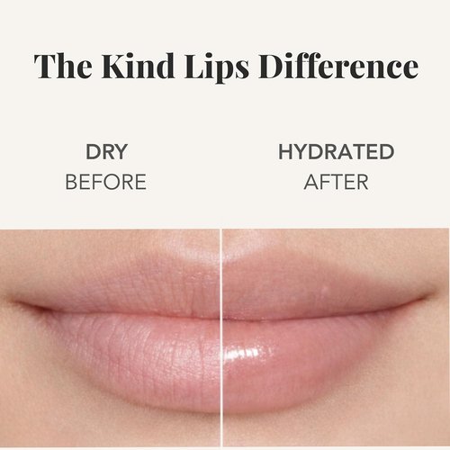 Kind Lips Organic Lip Balm Variety Pack - Moisturizing Beeswax Balm for Dry, Cracked Lips | Gift Set of 3