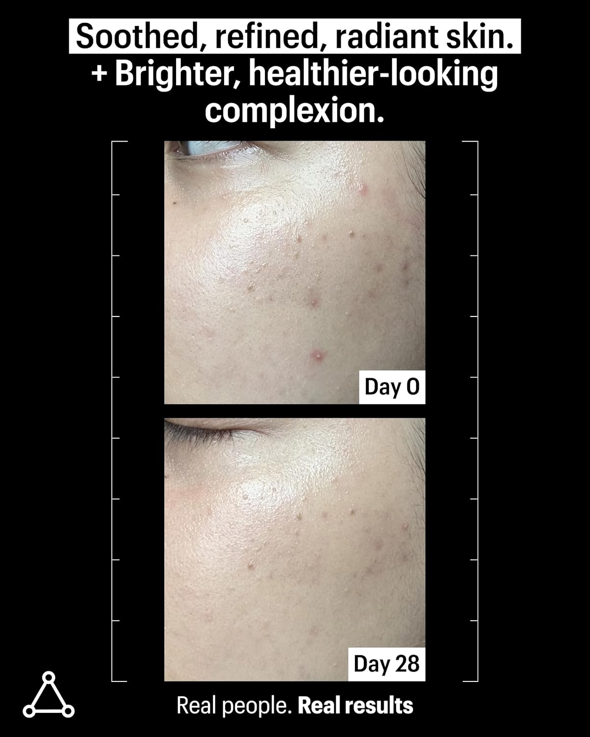 Allies of Skin 20% Vitamin C Serum - Daily Glow & Firming Face Serum | Lightweight Waterless Formula for Uneven Tone & Spots | 1 fl oz