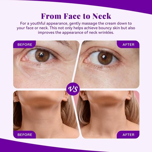ANAI RUI Bakuchiol Face Cream - Natural Retinol Anti-Aging Moisturizer with Squalane & Collagen | 1.7 Oz