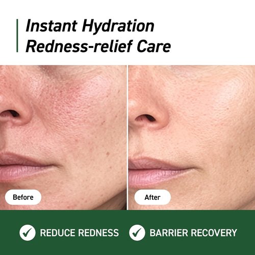 IVOSKIN Cica Redness Relief Cream - Soothing Green Moisturizer with Madecassoside for Sensitive Skin | 1.76oz / 50g