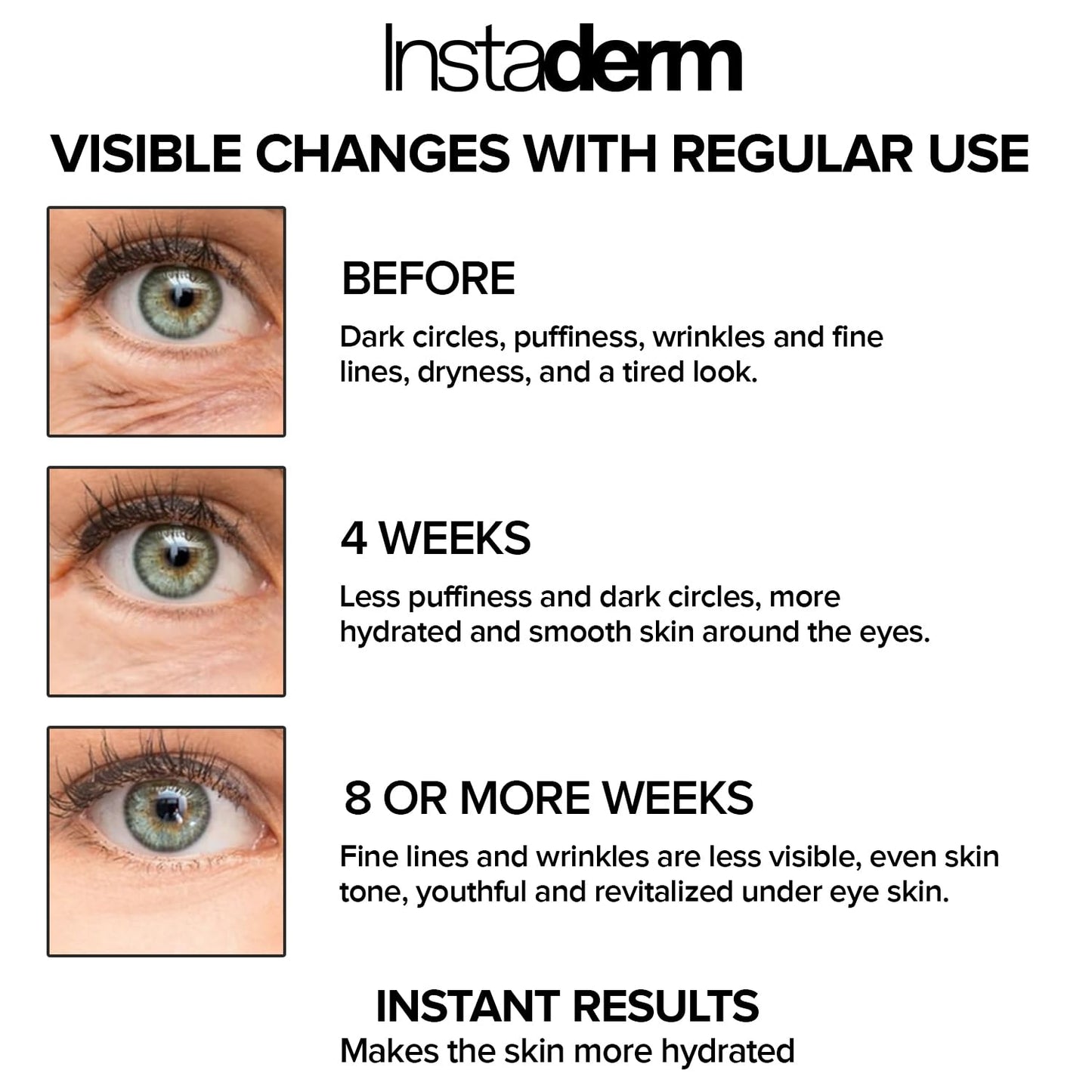Skiennix Eye Repair Cream - Anti-Aging Formula with Niacinamide to Reduce Dark Circles & Puffiness | Hydrates & Brightens Skin