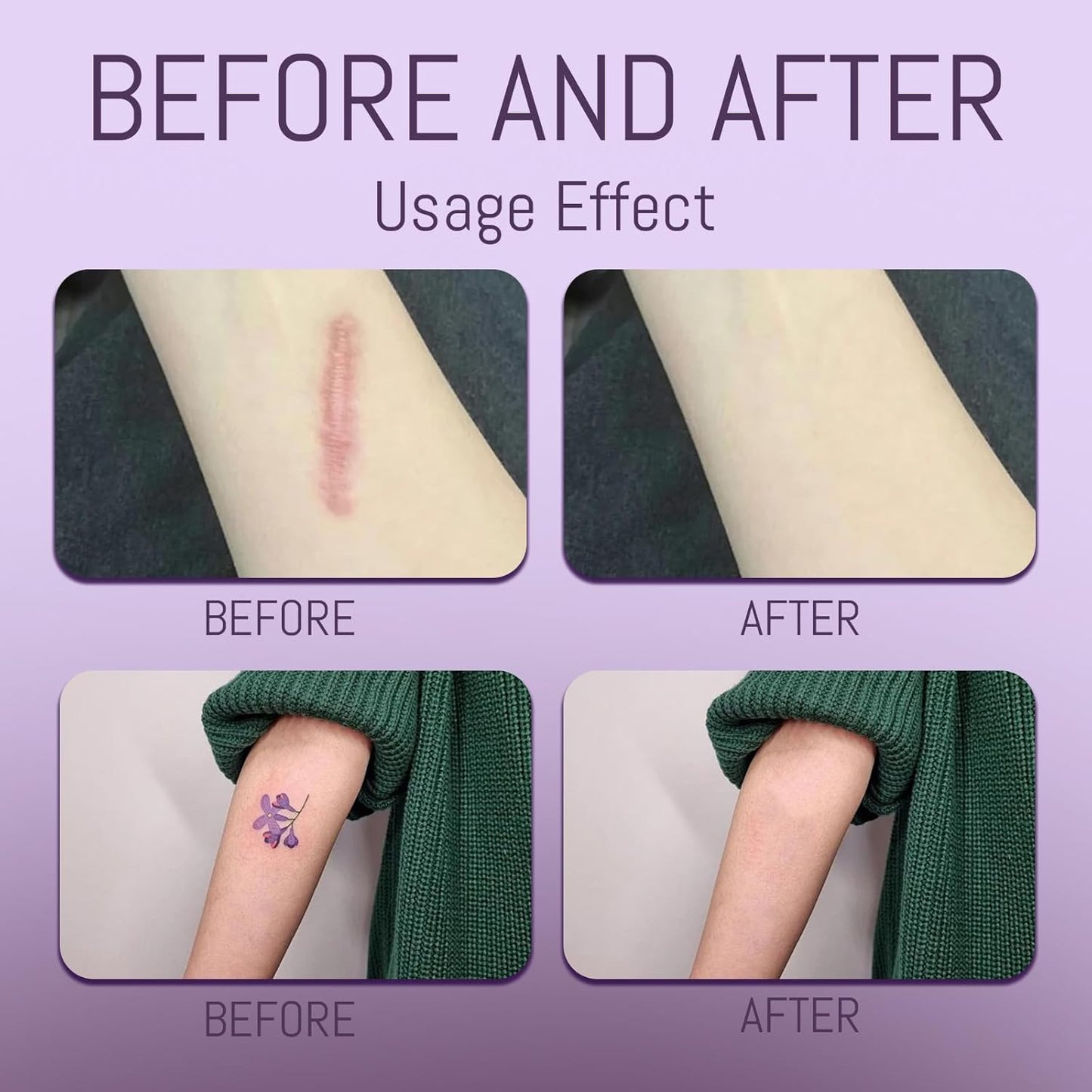 Skiennix Body Coverage Perfector - Waterproof Makeup with Brush & Puff | Full Coverage for Tattoos, Scars (2.0oz Natural Beige)