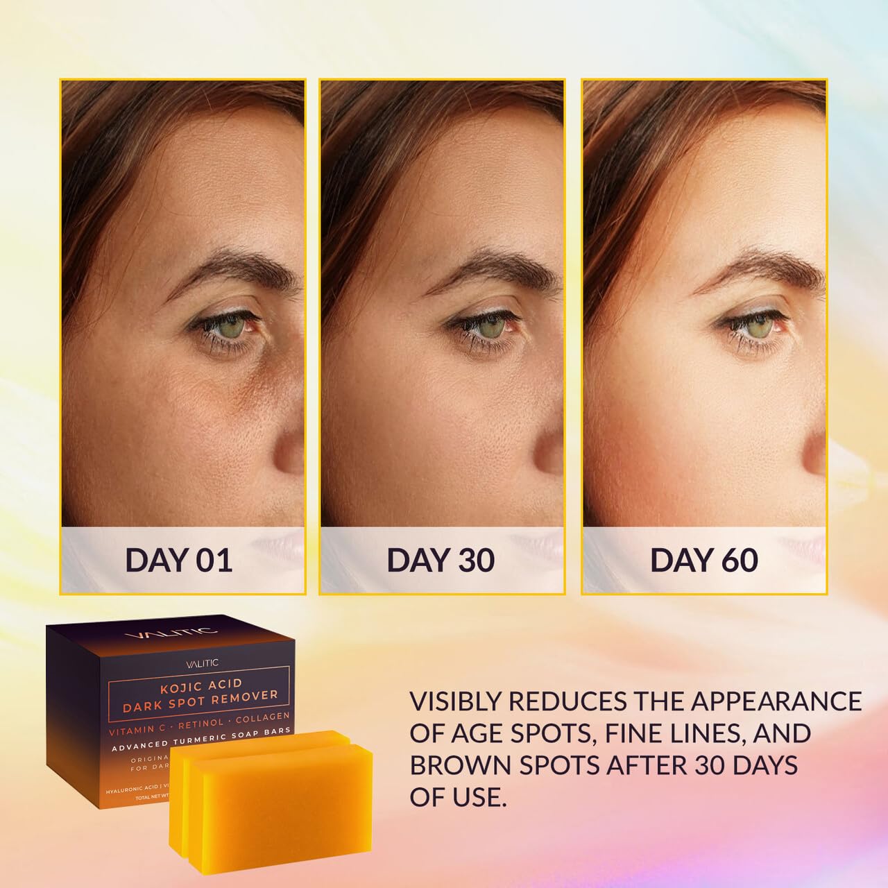 VALITIC Kojic Acid Dark Spot Remover Soap Bars - Infused with Vitamin C, Retinol & Turmeric (2 Pack)