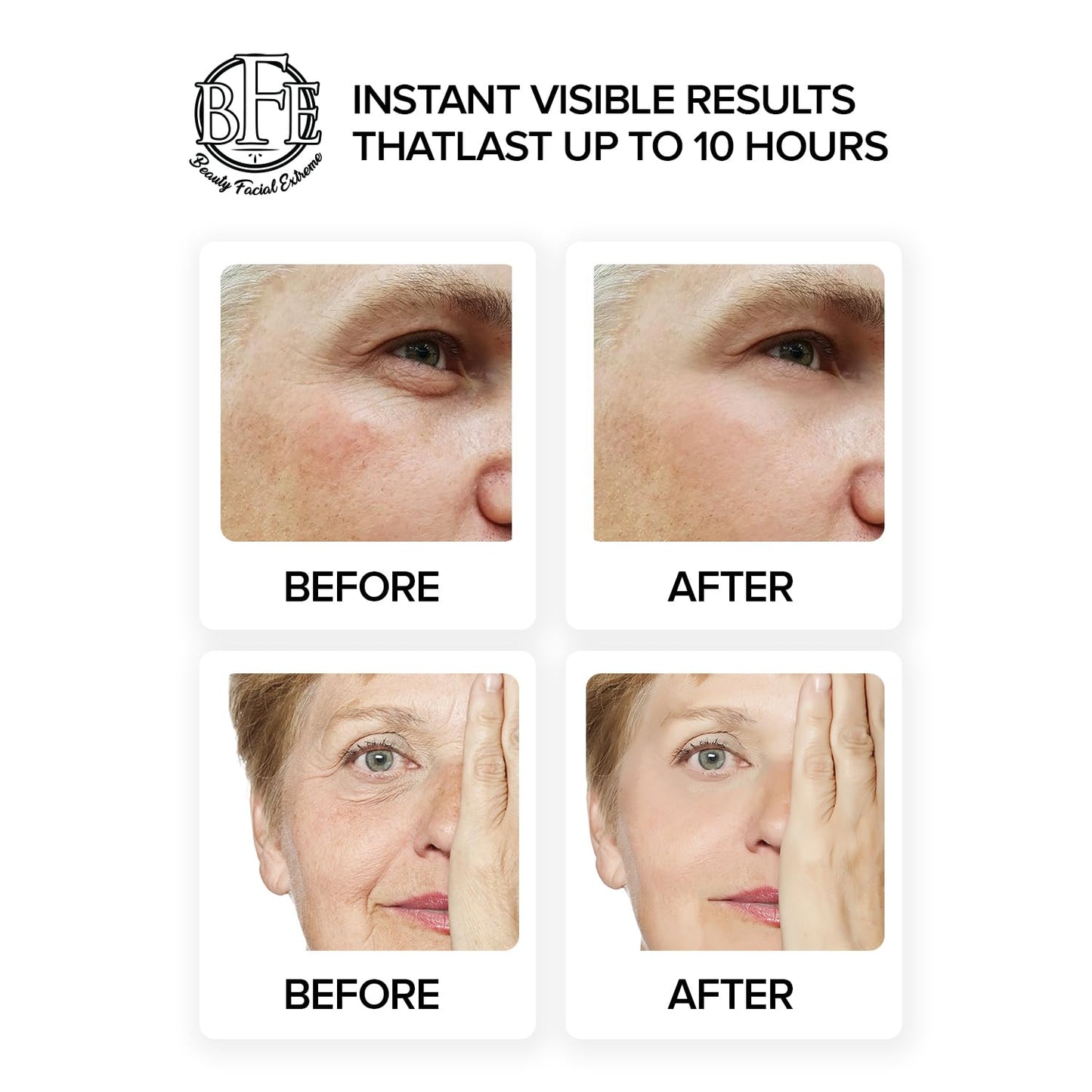Skiennix Instant Eye Tightener Cream - Reduces Puffiness & Dark Circles | Firm & Lift Sagging Skin
