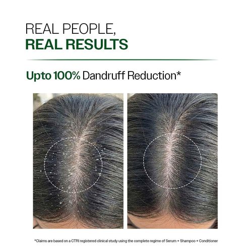 Bare Anatomy Expert Anti-Dandruff Shampoo - Up to 100% Dandruff Reduction | Oily Scalp Relief | 25.5 Ounce