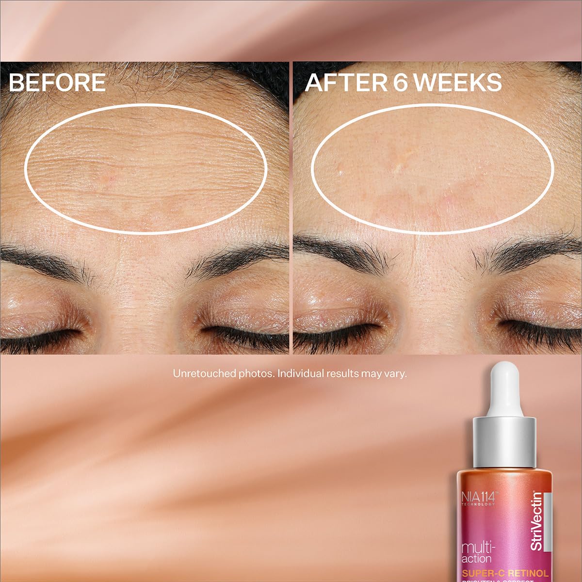 StriVectin Multi-Action Super C Retinol Serum - Brightening & Correcting Formula for Radiant Skin