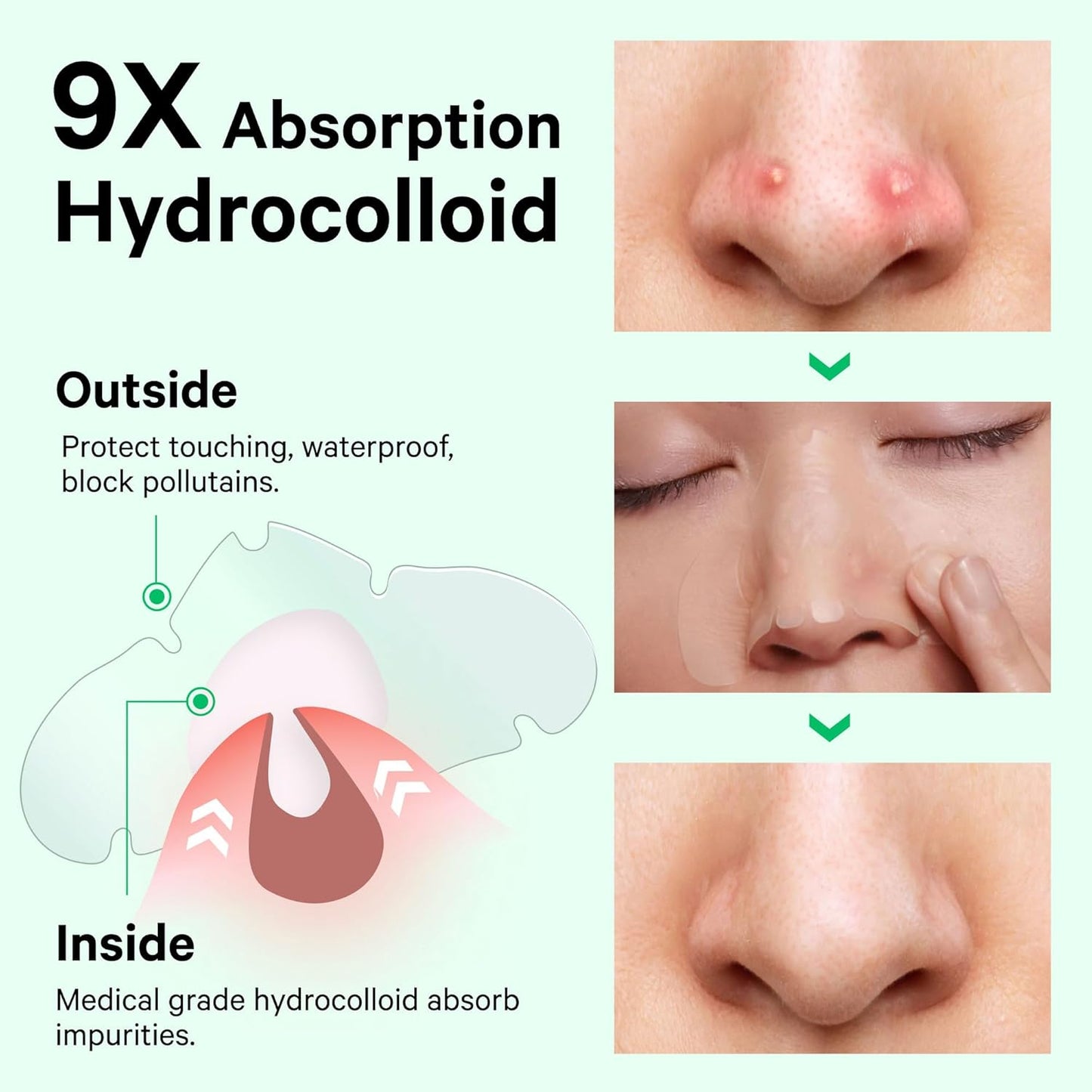 Sosky Hydrocolloid Nose Patches - Overnight Oil Absorbing Acne Strips for Clear Skin | 14 Count