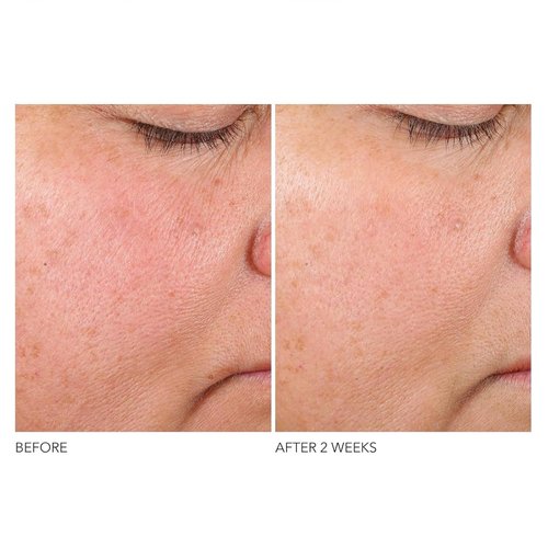 Dr. Dennis Gross Advanced Retinol Serum - Anti-Aging Formula to Smooth Texture & Boost Radiance, 1 oz