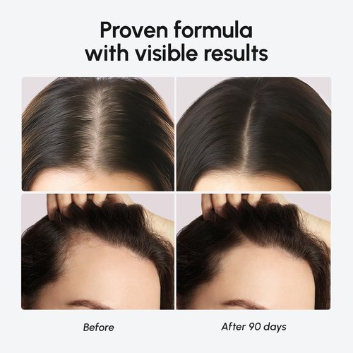 MAREE Hair Growth Vitamins - Biotin & Collagen Complex for Thicker, Faster Hair Growth - 120 Pills